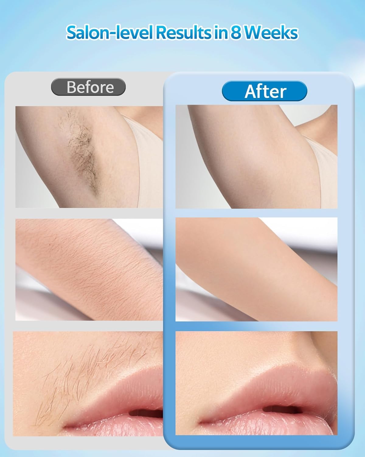 OPT Laser Hair Removal For Women And Men, At-Home Laser Hair Removal with Ice Cooling,IPL Laser Hair Removel with 999999 Flashes, Hair Removal Device for Face Leg Armpit Arm Bikini Line, Max 25J
