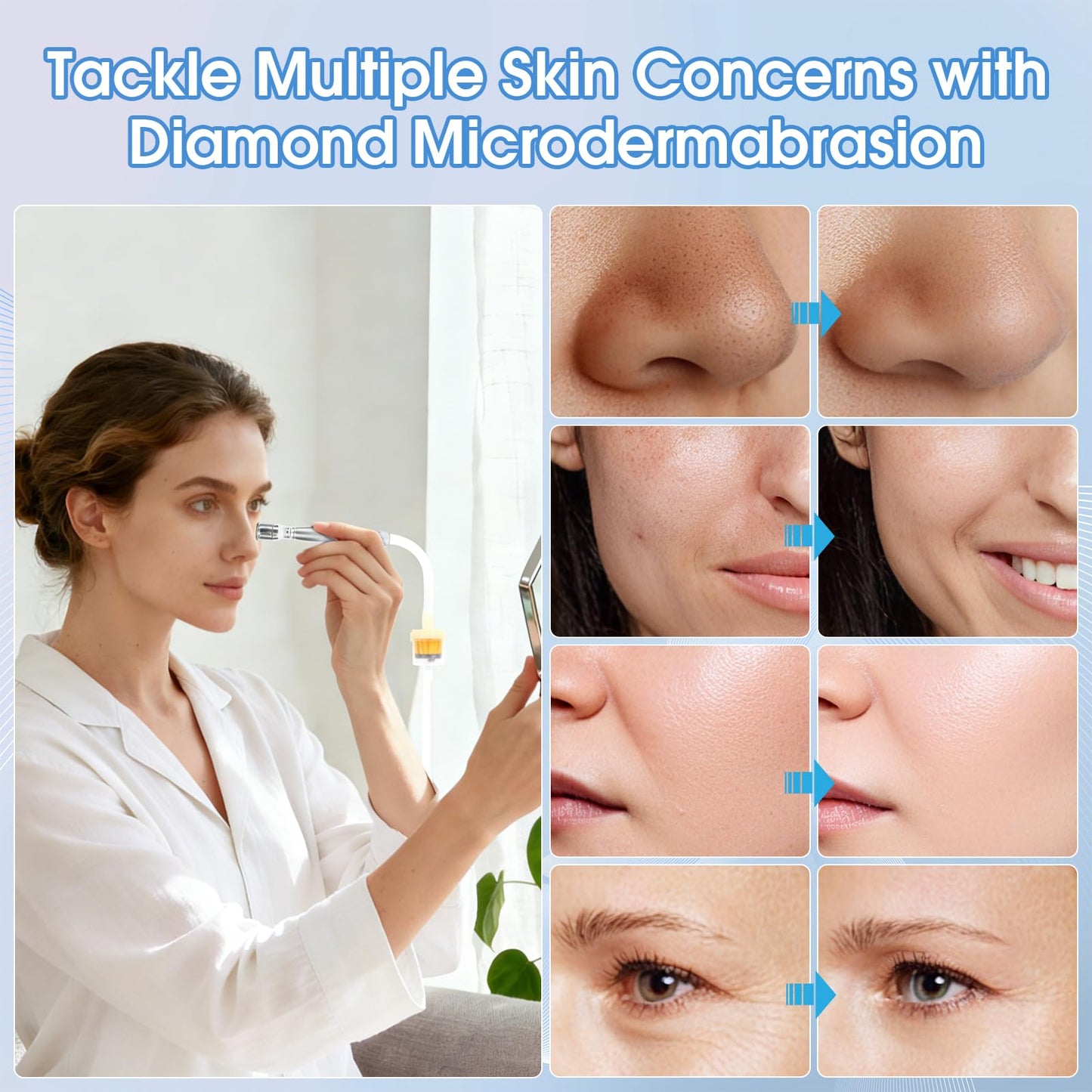 Pro Cordless Microdermabrasion Machine, Beauty Star Portable Facial Pore Vacuum Tool for Blackhead Removal, Glowing Skin, 3 Diamond Tips & 9-Setting Suction, Home and Salon Use