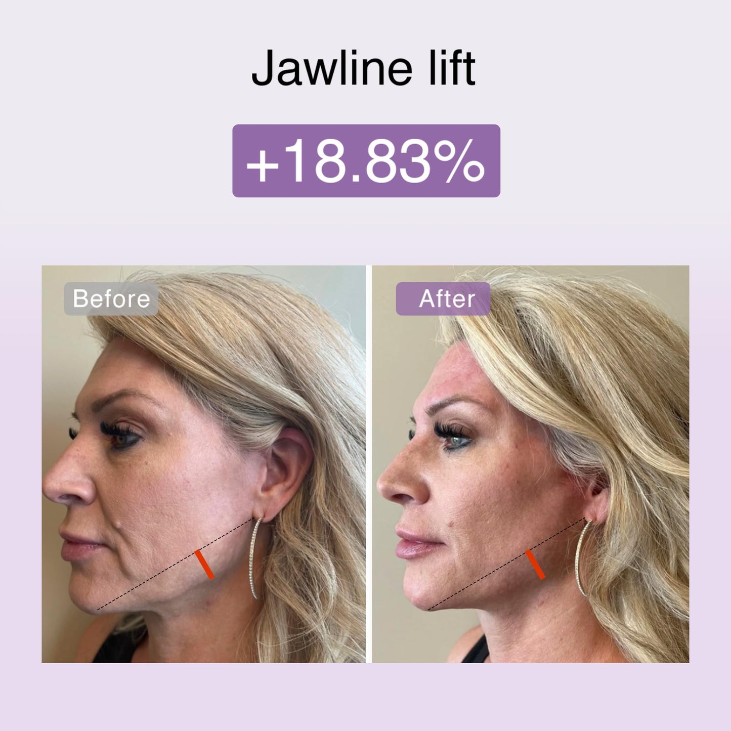 DermRays M1 4-in-1 Facial Toning Tool with Multi-Leading Tech for a Visibly Radiant & Youthful Appearance