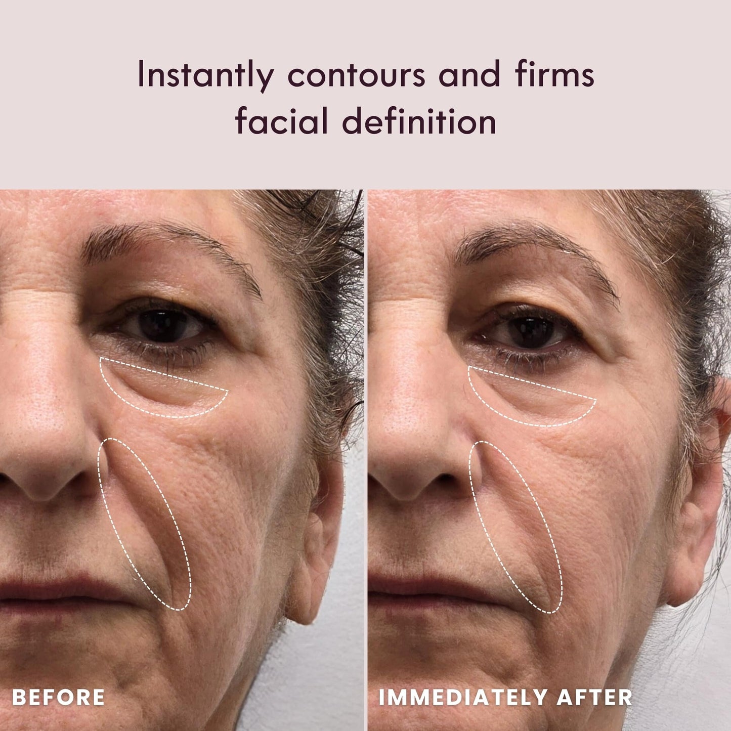 Laduora Lumeo 4-in-1 SkinLift Beauty Device + Serum Kit | Pro Glow System for Face & Neck